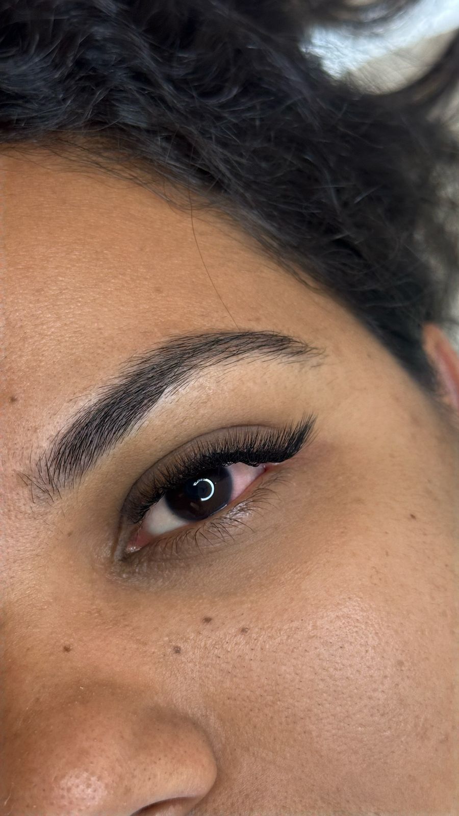 Resultado real do efeito Lifting realizado por Sabrina Laguna